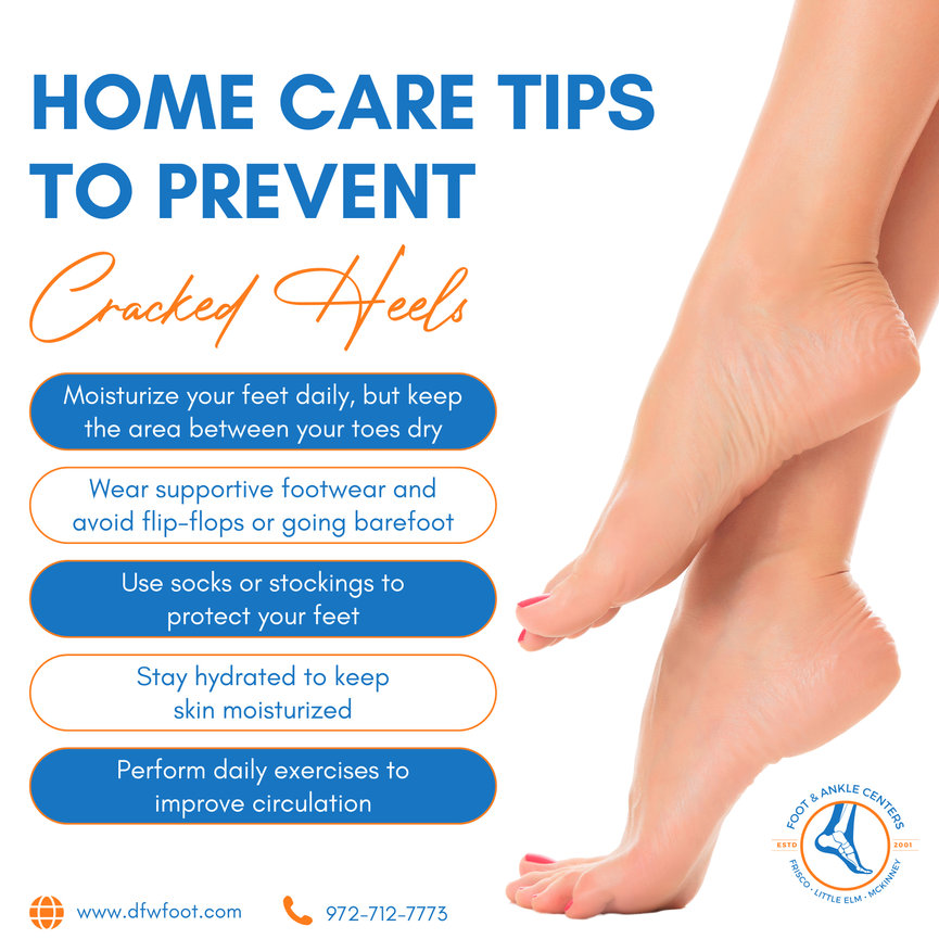 Modify and adapt existing sandals