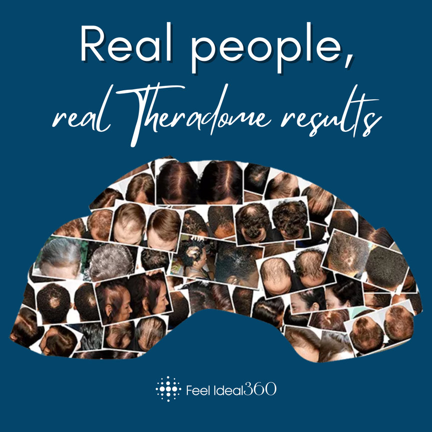 Theradome® Laser Hair Helmet Effortless Hair Regrowth Feel Ideal 360